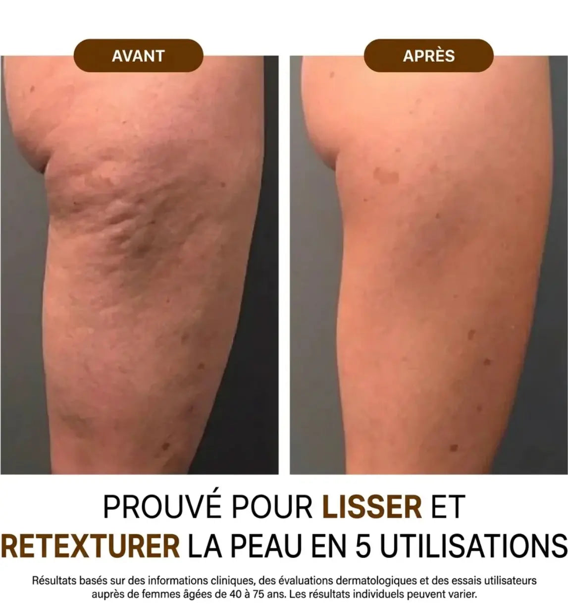 L'huile raffermissante pour une peau plus lisse et plus ferme