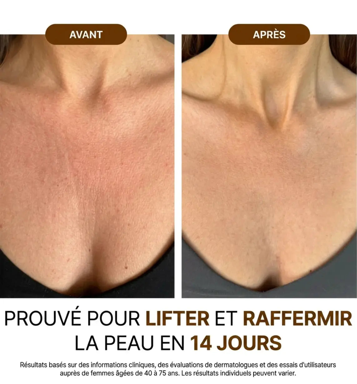 L'huile raffermissante pour une peau plus lisse et plus ferme