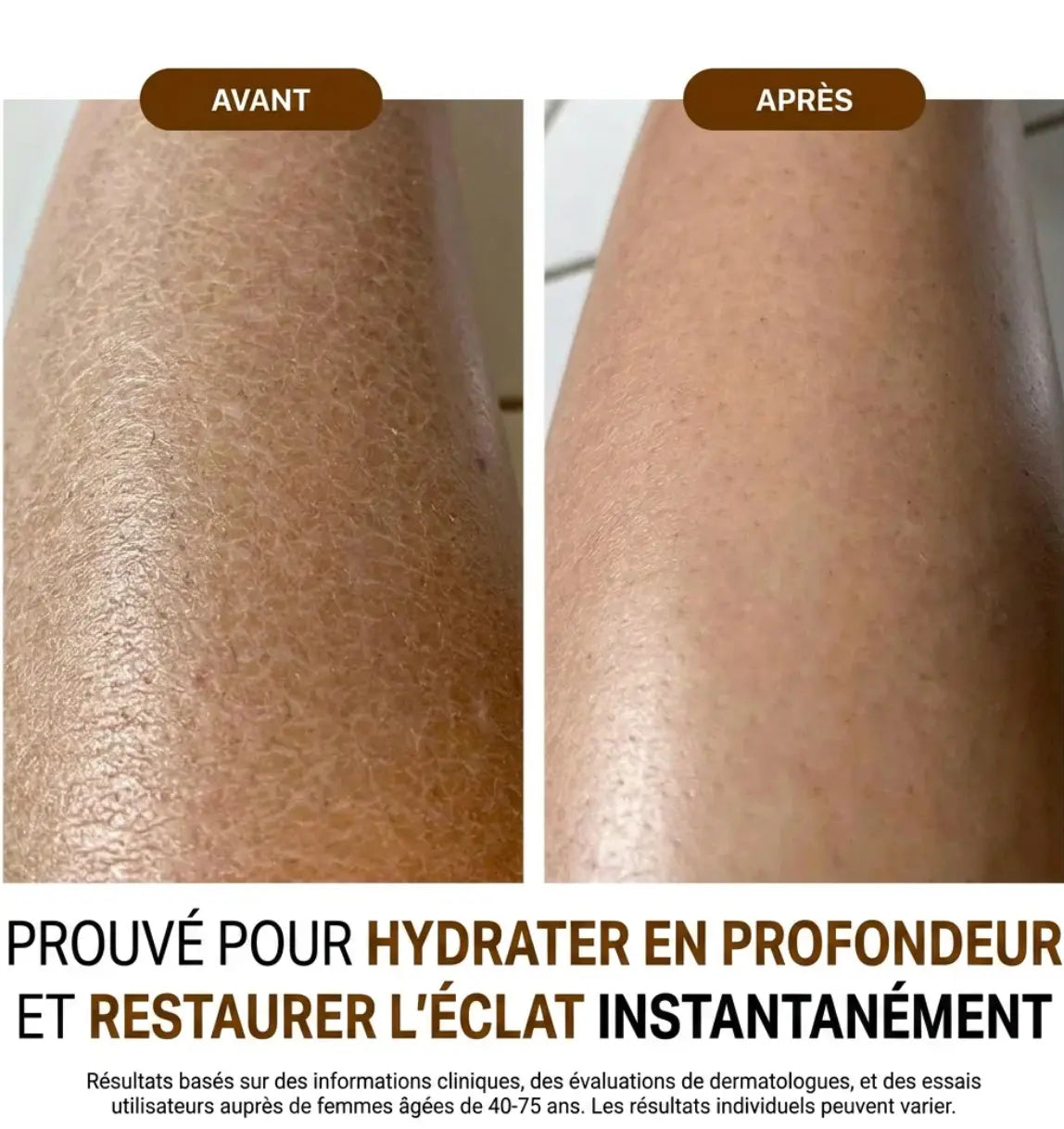 L'huile raffermissante pour une peau plus lisse et plus ferme
